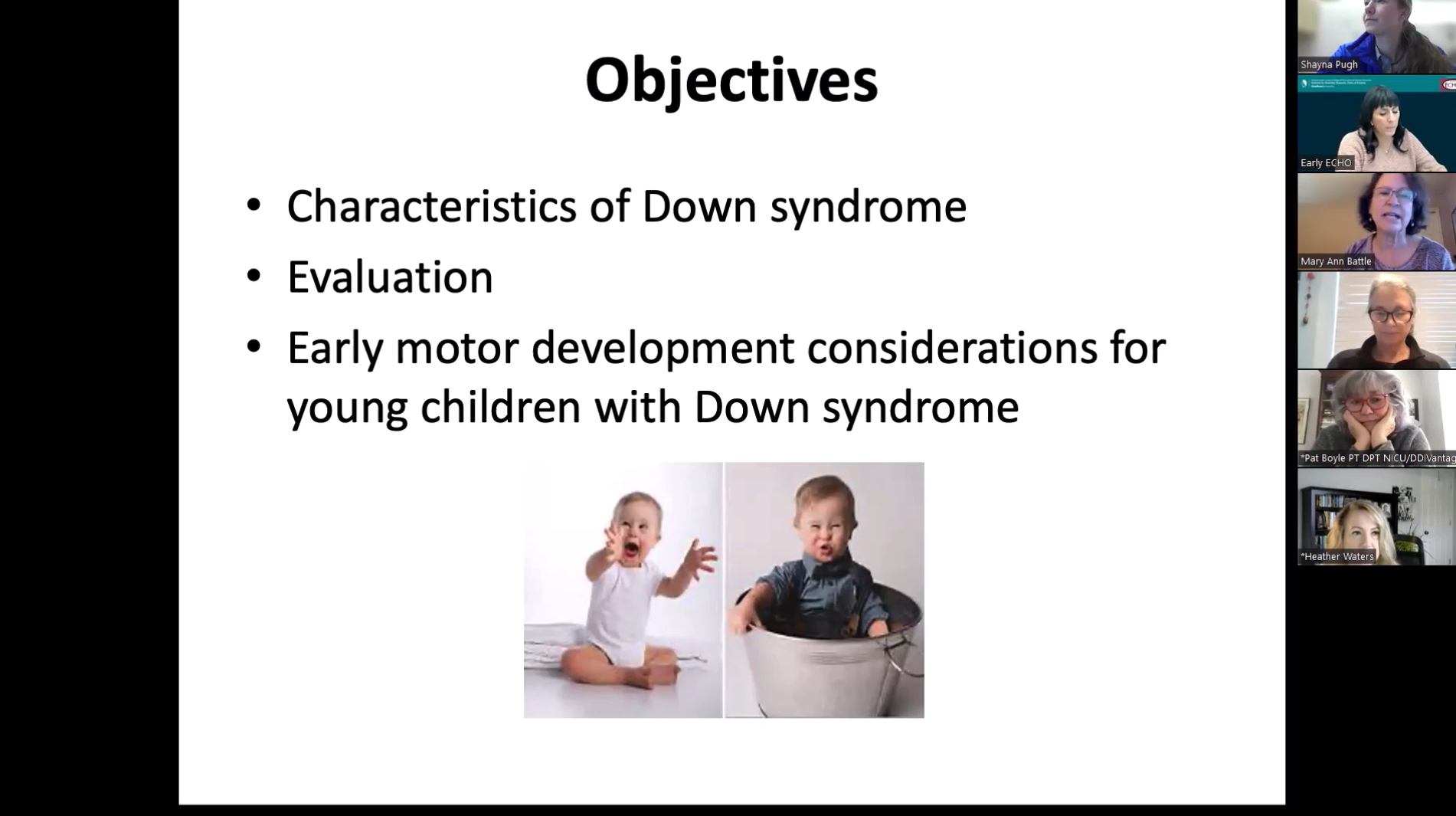 Down Syndrome Part 2: Physical Activity in Down Syndrome